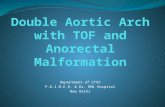 Double Aortic Arch with TOF