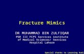 Fracture Mimics Dr. Muhammad Bin Zulfiqar