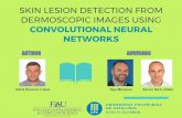 Skin Lesion Detection from Dermoscopic Images using Convolutional Neural Networks