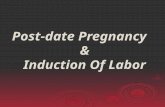 Post date and induction of labor