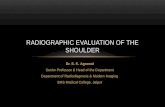 Radiographic evaluation of shoulder