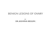 Benign diseases of ovary