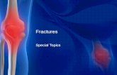 Fractures Special Topics.  1654429n&tag=related;photovideo 1654429n&tag=related;photovideo.