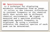 MR Spectroscopy is a technique for displaying metabolic information from an image. It relies on the inherent differences in resonant frequency or the chemical.