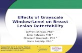Effects of Grayscale Window/Level on Breast Lesion Detectability Jeffrey Johnson, PhD a John Nafziger, PhD a Elizabeth Krupinski, PhD b Hans Roehrig, PhD.