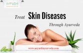 Ayurvedic Treatment For Skin Diseases In Kochi | Treatment For Skin Disorders In Kerala