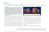 Wilms Tumor: An Uncommon Entity in the Adult Patient · PDF fileWilms Tumor: An Uncommon Entity in the Adult Patient