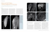 Bone and Soft Tissue - Clinical MRIclinical-mri.com/.../Bone_and_Soft_Tissue_Tumor_Pianta_Flash50.pdf · Imaging of bone and soft tissue tumors has progressed in line with technological