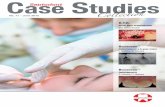 C Sepstodeont Studies - Septodont Studies 11 BD_0.pdf · Pulpotomy on a 6-year molar ... Each new issue of the Case Studies Collection is the ... Case Report no.1 tion (5).