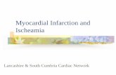 Myocardial Infarction and Ischeamia - csnlc.nhs.uk · PDF fileprint for life of a previous myocardial infarction ... positioned directly over the area of infarct fingerprint for life