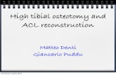 High tibial osteotomy and ACL reconstructiontraumatologiasportiva.com/wcms/ftp//t/traumatologiasportiva.com/... · High tibial osteotomy and ACL reconstruction Matteo Denti Giancarlo