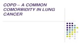 COPD A COMMON COMORBIDITY IN LUNG CANCER - SRP A COMMON COMORBIDITY I… · Lung cancer is the number one cause of death from cancer worldwide Approximately 85% of lung cancer occurs