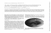 A case neovascularisation in uveitis - British Journal of ...bjo.bmj.com/content/bjophthalmol/66/8/530.full.pdf · Acase ofmacularsubretinal neovascularisation in chronic uveitis