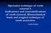 Operation technique of tooth removal I. Indications and ...semmelweis.hu/szajsebeszet/files/2017/02/Fogeltávolítás-indik... · -Odontogenic sepsis . Indications of tooth removal