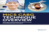 MICS CABG TECHNIQUE OVERVIEW -  · PDF fileMICS CABG TECHNIQUE OVERVIEW Minimally Invasive Cardiac Surgery Coronary Artery Bypass Graft Procedure