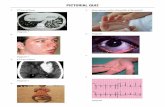 PICTORIAL QUIZ - The Association of Physicians of · PDF fileMCQ 's 1322 1. CT thorax showing bronchiectatic changes 2. Adenoma sebaceousum 3. ... Pictorial Quiz - Answers 29. c 30.
