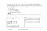 ECG Interpretation: The Basics - Ask Doctor · PDF fileECG Interpretation: The Basics This short introduction to ECGs uses a systematic approach to aid pattern recognition. It does