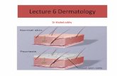 Lecture 3 Dermatology - kfs.edu.eg · PDF filethe most dangerous type of ... clusters of small patches of hyperpigmented area (concentrated melanin) which are most often visible on