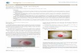 Surgery: Current Research - OMICS International · PDF fileSurgery: Current Research Soyder and Özgün, Surgery Curr Res , httpd.doi.org.. 39 ... Trephine loop sigmoid colostomy technique