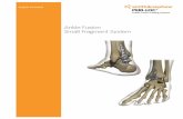 Ankle Fusion Small Fragment System - Smith & Nephew · PDF fileAnkle Fusion Small Fragment System. 2 Product overview Indications The Smith & Nephew PERI-LOC Ankle Fusion Plating System