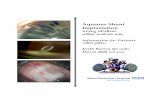 Aqueous Shunt Implantation zimrn& ai[pr[Sn zimrn& …migs.org/wp-content/uploads/Tube-Gujarati.pdfAqueous Shunt Implantation, K Barton, Moorfields Eye Hospital NHS Foundation Trust,