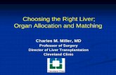 Choosing the Right Liver; Organ Allocation and Matching · PDF fileChoosing the Right Liver; Organ Allocation and Matching ... Normal gross appearance of the liver ... DCD grafts are