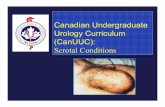 Canadian Undergraduate Urology Curriculum (CanUUC ... · PDF file(CanUUC): Scrotal Conditions. Objectives: Scrotal Conditions 1. ... Hydrocele Spermatocele ... Testicular Cancer: Types