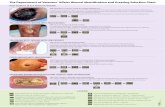 Wound identification and dressing selection chart · PDF fileThe Department of Veterans’ Affairs Wound Identification and Dressing Selection Chart PAGE 1 Hydrocolloid Sheet e.g.