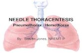 NEEDLE  · PDF fileNeedle Thoracentesis is the introduction of a needle or catheter into the pleural space to release trapped or accumulated air within the pleural space