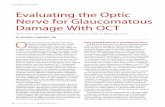 TECHNOLOG TODAY Evaluating the Optic Nerve for ...glaucomatoday.com/pdfs/gt0315_tech.pdfTECHNOLOG TODAY O ptical coherence tomography (OCT) has become an important tool for the clinical