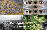 Radiographic Lung Patterns - Veterinary Radiology ... … · patterns INTERSTITIAL ALVEOLAR BRONCHIAL VASCULAR NODULAR Some cause DECREASED OPACITY emphysema, air ... Neoplasia -
