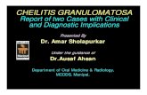 Presented By Dr. Amar Sholapurkar - James Cook … By Dr. Amar Sholapurkar Under the guidance of ... gingivoplasty was advised. ... 8.ppt [Compatibility Mode]