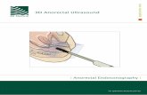 3D Anorectal Ultrasound - Medical-bg.infomedical-bg.info/resources/3Danorectal.App.noteBo0008.pdf · 3D anorectal ultrasound, with the improved ... The value of endoanal ultrasound