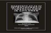 DIAGNOSTIC ATLAS OF INTRATHORACIC … ATLAS OF INTRATHORACIC TUBERCULOSIS IN CHILDREN ... radiological pictures of intrathoracic tuberculosis, ... of TB infection …