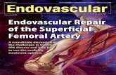 Endovascular Repair of the Superficial Femoral Arterybmctoday.net/evtoday/pdfs/0908_supp.pdf · ENDOVASCULAR REPAIR OF THE SUPERFICIAL FEMORAL ARTERY ... small vessel, I know that