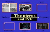 The uterus and IVF - D. de Ziegler - Geneva Foundation … uterus and IVF Embryo Pregnancy Contractility Doppler 3D Embryo The uterus Pregnancy and IVF Biology of endometrial receptivity