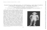 Apparent G-Monosomy, G-Deletion, and Down's Syndrome …jmg.bmj.com/content/jmedgenet/9/4/457.full.pdf · matedas 54bythe Terman-Merill (revised) intelligence test. Hisfacial expression