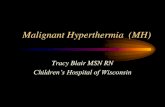 Malignant Hyperthermia (MH)/media/Files/Medical Professionals/Nursing...What is Malignant Hyperthermia? MH is a biochemical chain reaction response, “triggered” in susceptible