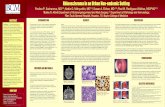 Rhinoscleroma in an Urban Non-endemic Setting€¦ · He was previously treated for allergic rhinitis by his ... crusting and atrophic mucosal changes. ... rhinoscleroma poster final
