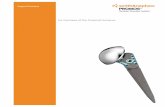 For Fractures of the Proximal Humerus - Smith & … Fractures of the Proximal Humerus . Smith & Nephew thanks the following surgeons for their participation ... comminution and osteoporosis.