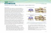 Degenerative Disc Disease (spondylosis) - The Iowa … 1 Degenerative disc disease is a spinal condition caused by the breakdown of your intervertebral discs. As you age, your spine