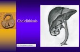 Cholelithiasisksumsc.com/download_center/3rd/Females/1st Semester...Dr. Abdulsalam Alsharabi Harvest Time Anatomy Variations in Bile Ducts Gallstone Pathogenesis Ultrasound Ultrasound
