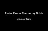 Rectal Cancer Contouring Guide · – NOTE: this was created for BOTH anal and rectal cancer, which are treated quite diﬀerently, so pay aenIon!