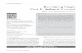 Redefining Single Visit Endodontic Protocol - rep.nacd.inrep.nacd.in/ijda/06/02/06.02.11550.pdf · in endodontic armamentarium: surgical microscopes/ magnifying loupes, nickel titanium