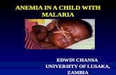 ANEMIA IN A CHILD WITH MALARIA€¦ · PPT file · Web view · 2017-02-02…..CASE REPORT . At the time of admission child was in coma. Blantyre coma scale of 2/5. In obvious distress.