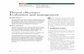 Pleural effusions: Evaluation and management · 854 CLEVELAND CLINIC JOURNAL OF MEDICINE VOLUME 72 • NUMBER 10 OCTOBER 2005 JOSÉ C ... will reveal the etiology in most cases. ...