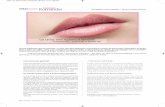 Romandie IMADERM - yoelelbaz.ch · -/ Plump, perfectly-shaped lips are a shortcut to seduction – but time can take its toll. Remodelling is one of the best ways to ensure your lips