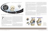 The Perfect Fit Customizing Your Knee Replacement …dallaslimbrestoration.com/pdfs/dr-buch-living-well.pdfpatients are still having an off-the-shelf ... after total knee replacement