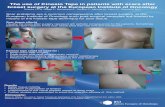 The use of Kinesio Tape in patients with scars after breast ... Kinesio tape scars.pdfKenzo K; Wallis J.;Tsuyoshi K. Clinical Therapeutic Applications of thr Kinesio Taping® Method