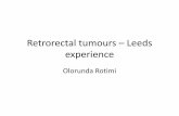 Retrorectal tumours Leeds experience - Virtual Pathology€¦ · TGC •Develops from post anal foetal gut remnants •Often multicystic •Can contain a variety of epithelia between